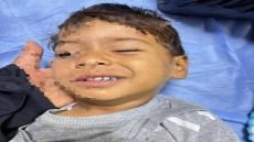 في حالة نادرة”.. طفل بعمر 3 سنوات يتعرض لجلطة دماغية بعد ان كان يعاني من ارتفاع في درجة حرارته، في محافظة النجف الاشرف.