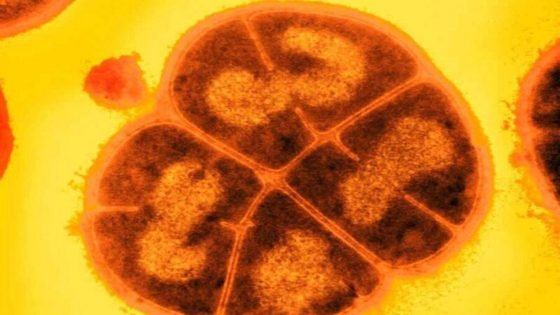 بكتيريا خارقة لا تموت تتحمل الإشعاع والجفاف وحتى فراغ الفضاء