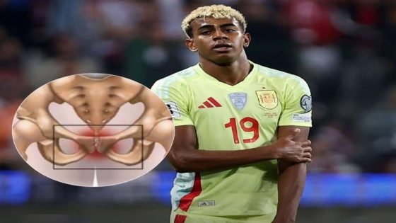 اصابة اللاعب “لامين يامال” في منطقة العانة قد تؤدي الى تغيبه عن مباراة نيوكاسل في دوري أبطال أوروبا