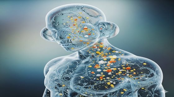 التسمم المائي