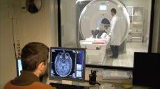 باحثون يابانيون يكشفون سر “ضبابية الدماغ” لدى مصابي كوفيد طويل الأمد