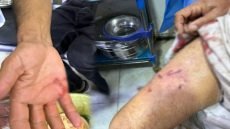 “بينهم أطفال”.. إصابة 7 أشخاص بجروح مختلفة بعد تعرضهم لهجوم من كلاب سائبة في قضاء الحمزة الشرقي جنوبي الديوانية.