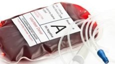 “في خبر مبشر لمرضى الكلى حول العالم”.. علماء من كندا والصين يُعلنون عن نجاحهم في تطوير “كِلية عالمية” بالإمكان نظرياً زراعتها لأي مريض مصاب بفشل كلوي أو يعاني من مشاكل في الكلى بصرف النظر عن فصيلة دمه.