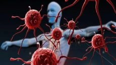 دراسة طبية تكشف آلية جديدة تستخدمها الخلايا السرطانية لاستئناف النمو بعد العلاج عبر استغلال إنزيم مرتبط بموت الخلية