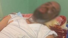 إصابة شخص بحروق بعد قيام مجموعة من أقاربه برمي مادة التيزاب على وجهه بسبب مشكلات عائلية في النجف الأشرف