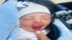 في حالة طبية نادرة.. قلع “سن لبنية” من فم طفل حديث الولادة في محافظة بابل.