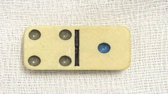 استخراج “يك جهار” قطعة دومينو من معدة شاب بعملية جراحية في السليمانية.