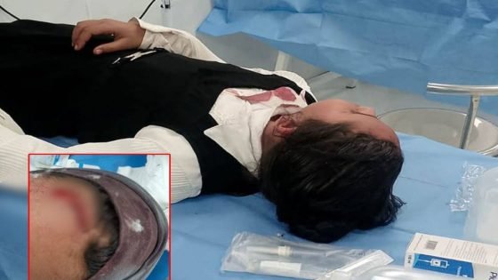 إصابة عدد من الطالبات بجروح في رؤوسهنّ؛ جراء انهيار جزء من سقف أحد الصفوف المدرسية في المثنى.