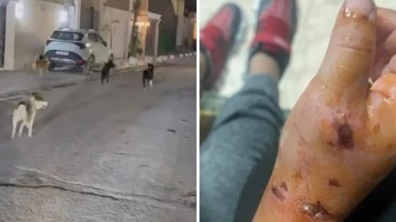 كلاب سائبة تمزق جسد طفل وتودي به إلى العناية المركزة، في الرمادي بمحافظة الأنبار.