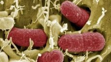 خبراء صحة يحذرون من الإفراط في أدوية الحموضة ويؤكدون دور النظام الغذائي في تعزيز ميكروبيوم الأمعاء