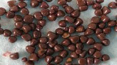 استخراج أكثر من 100 حصاة من كلية مريض عمره 35 عاماً في محافظة النجف الأشرف.