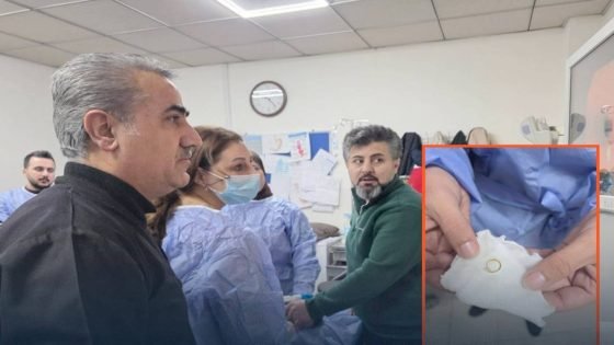 فريق طبي ينجح باخراج قطعة ذهب علقت بحنجرة رضيع عمره 4 اشهر، في محافظة السليمانية.