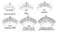 تحديد عمر الخروف عن طريق الأسنان،